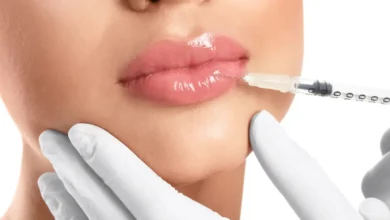 An Essential Guide to Starting a Profitable Lip Fillers Business