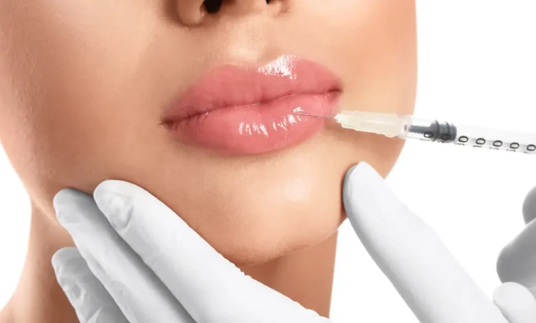 An Essential Guide to Starting a Profitable Lip Fillers Business